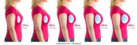 36l boobs|Breast Size Comparison Side by Side